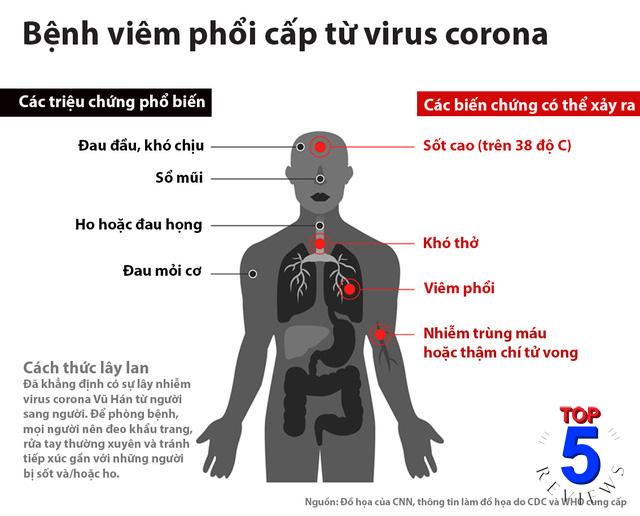 biểu hiện bệnh viêm hô hấp do Virus Corona